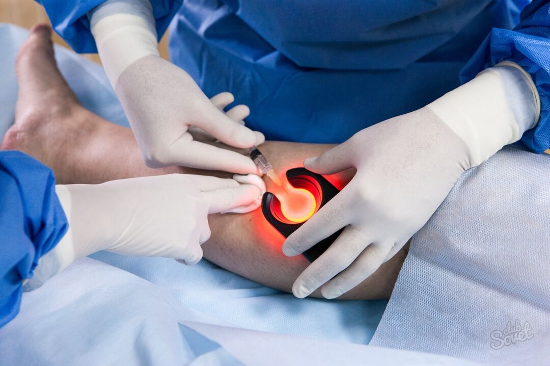 Varicose veins on the diagnostics of the foot