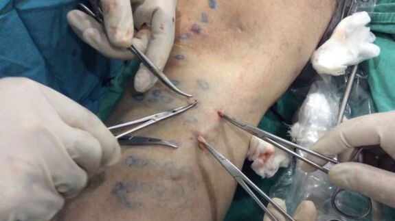 operation