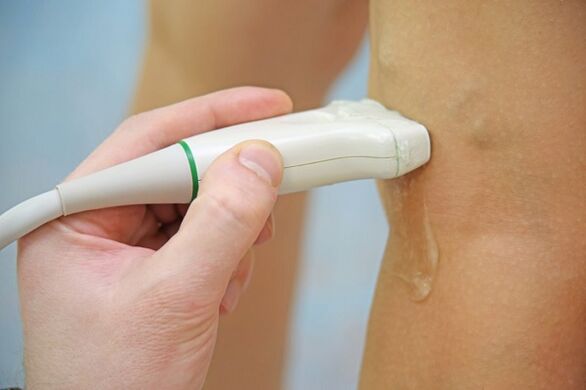 Ultrasound of veins